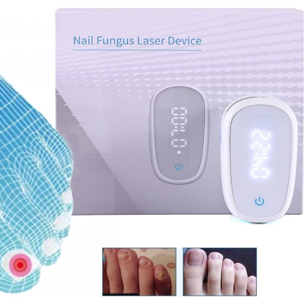 Aparat cu Laser pentru Indepartarea Onicomicozei si Tratarea Ciupercilor de Unghii, Portabil, Reancarcabil, Alb [10]
