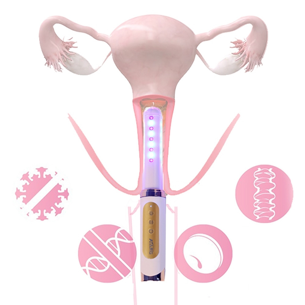 Bagheta Ginecologica cu Laser si Vibratii pentru Sanatatea Vaginala [4]