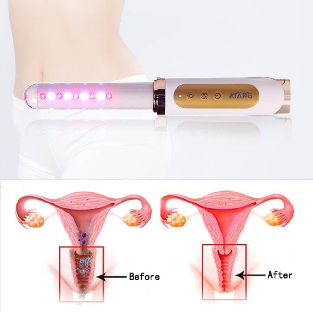 Bagheta Ginecologica cu Laser si Vibratii pentru Sanatatea Vaginala [26]