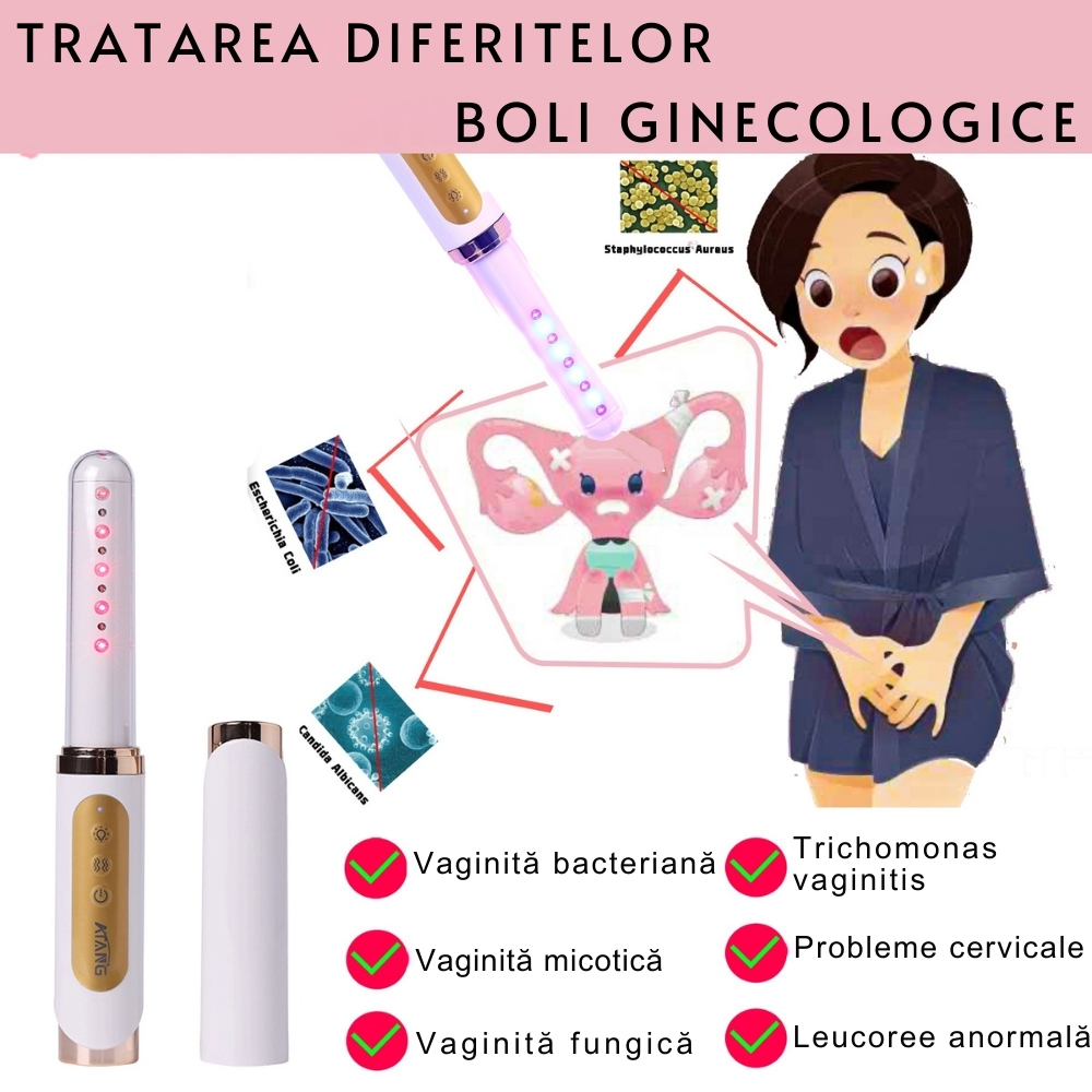 Bagheta Ginecologica cu Laser si Vibratii pentru Sanatatea Vaginala [27]