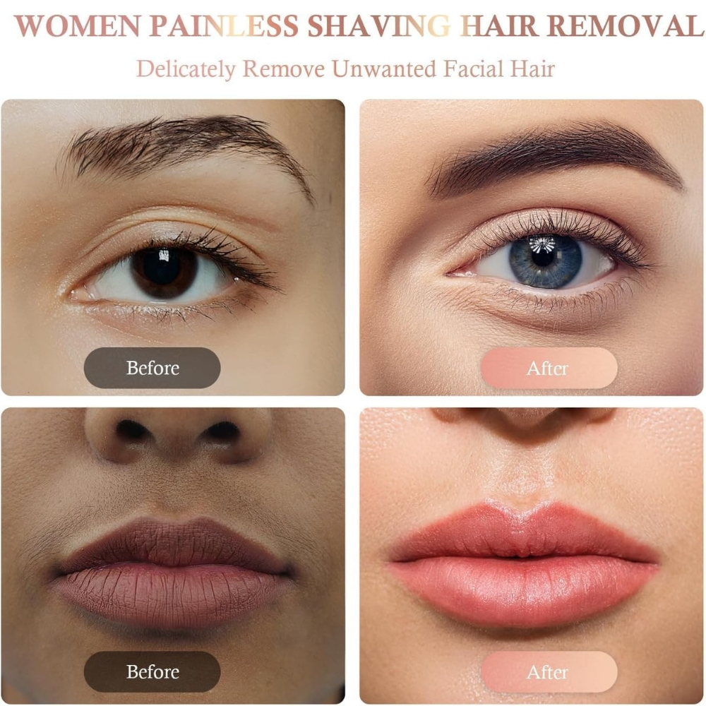 Epilator Facial Portabil, Indepartare Fina a Parului Nedorit [15]