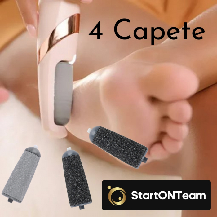 Set 4 Capete pentru Pila Electrică de Îngrijire a Călcâielor Crăpate - 2 Fine și 2 Grosiere [4]