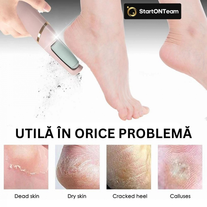Pila Electrica Profesionala cu acumulator pentru curatat calcaie crapate si piele uscata [13]