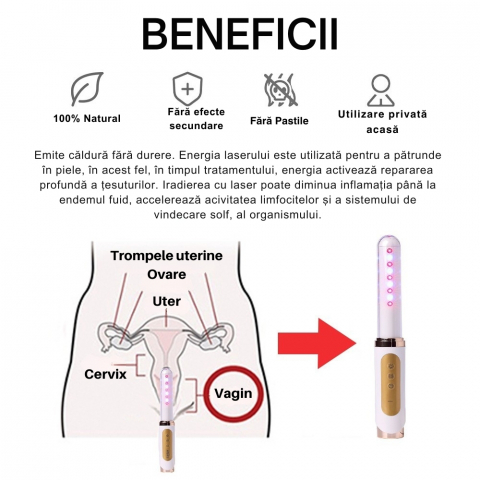 Bagheta Ginecologica cu Laser si Vibratii pentru Sanatatea Vaginala [19]