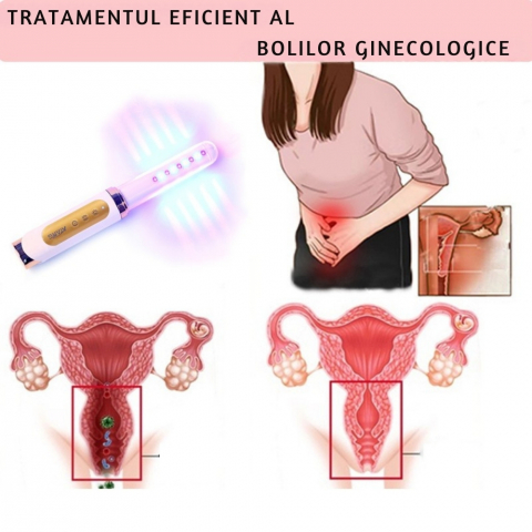 Bagheta Ginecologica cu Laser si Vibratii pentru Sanatatea Vaginala [12]