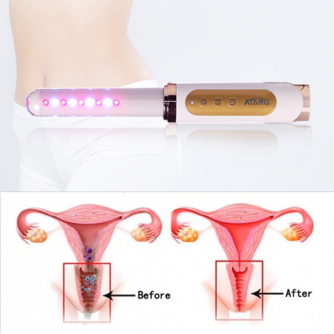 Bagheta Ginecologica cu Laser si Vibratii pentru Sanatatea Vaginala [25]