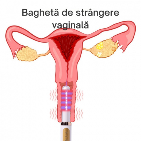 Bagheta Ginecologica cu Laser si Vibratii pentru Sanatatea Vaginala [30]