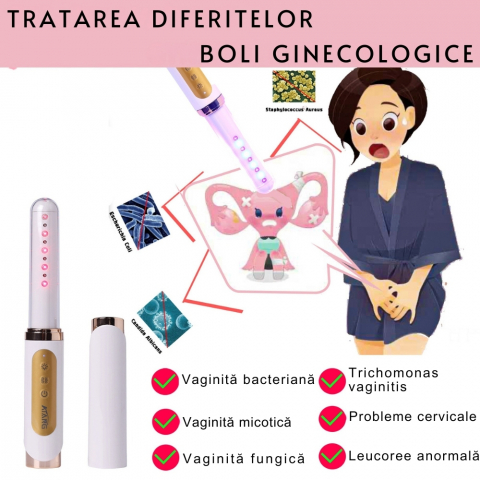 Bagheta Ginecologica cu Laser si Vibratii pentru Sanatatea Vaginala [26]