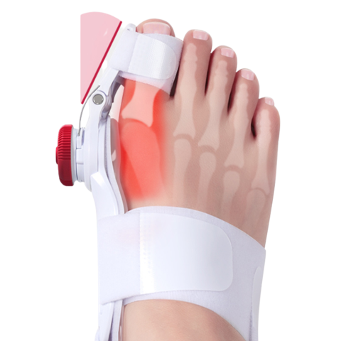 Corector monturi copii reglabil 3D pentru Hallux Valgus [1]