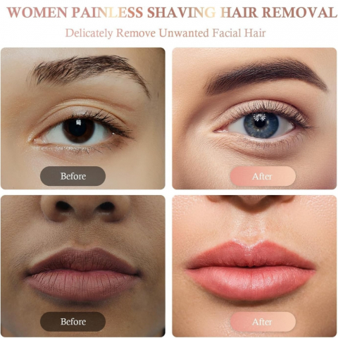 Epilator Facial Portabil, Indepartare Fina a Parului Nedorit [14]