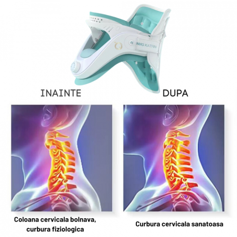 Guler Cervical pentru Spondiloza si Hernie Cervicala [16]