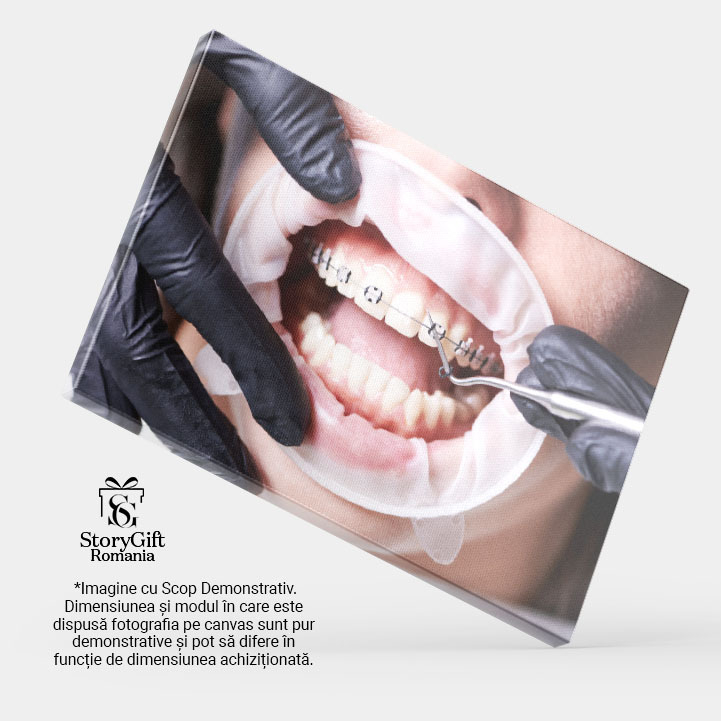 Tablou Canvas: Zambet perfect - ortodontie, aparate dentare, femeie, clinica dentara 40x25CM [4]
