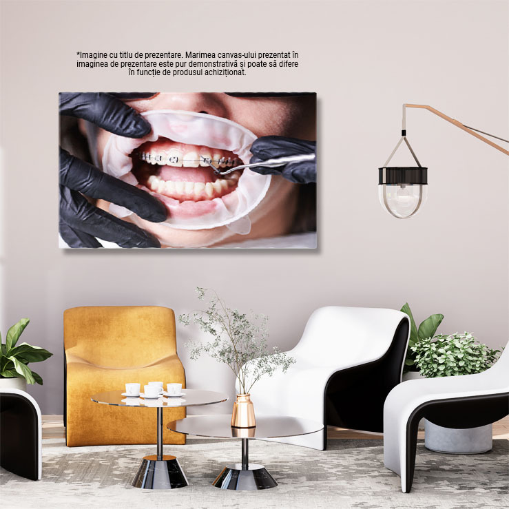 Tablou Canvas: Zambet perfect - ortodontie, aparate dentare, femeie, clinica dentara 40x25CM [3]