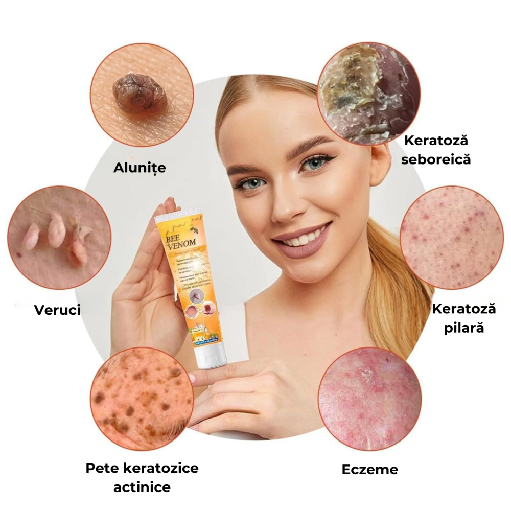 Crema Magica cu Extract de Venin de Albine – Solutia Ideala pentru O Piele Neteda si Sanatoasa, 2 X 30 g [6]