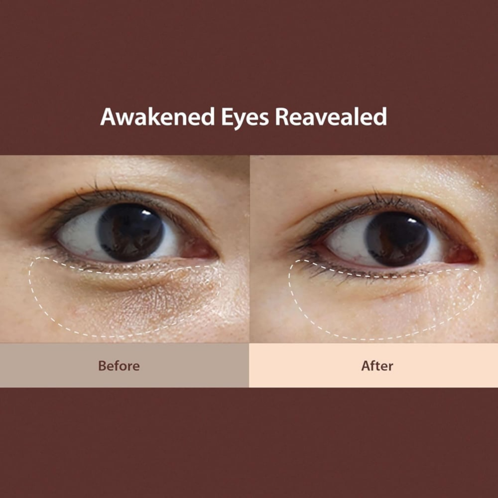 Ser Ochi Anti-Cearcane si Pungi, Cafeina 1%, Bakuchiol, Niacinamida, 20ml – Hidratare, Fermitate si Luminozitate​ [3]