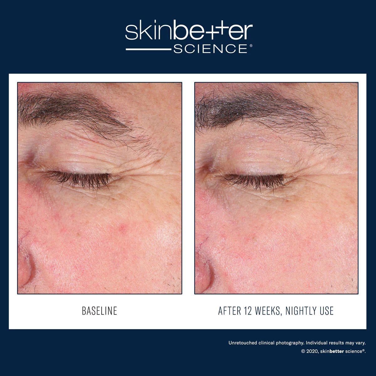 SkinBetter EyeMax AlphaRet Overnight Cream [3]