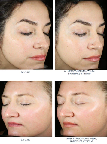 SkinBetter AlphaRet® Exfoliating Peel Pads [6]