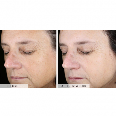 SkinBetter Even Tone Correcting Serum™ 50ML [1]