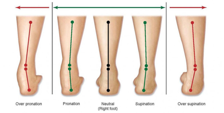 Brant/talonet corector 22/25 vine doar la calcai - pronatie/supinatie [2]