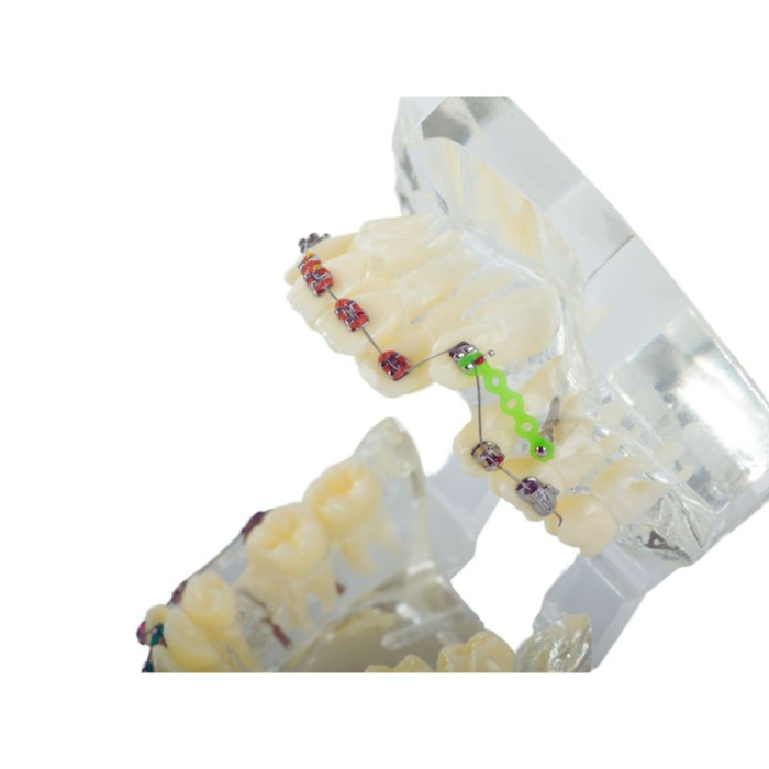 Model dentar maxilar realist cu dentitie si aparat ortodontic VarioShop®, instrument educational pentru cabinete stomatologice, igiena dentara, cursuri si demonstratii medicale [8]