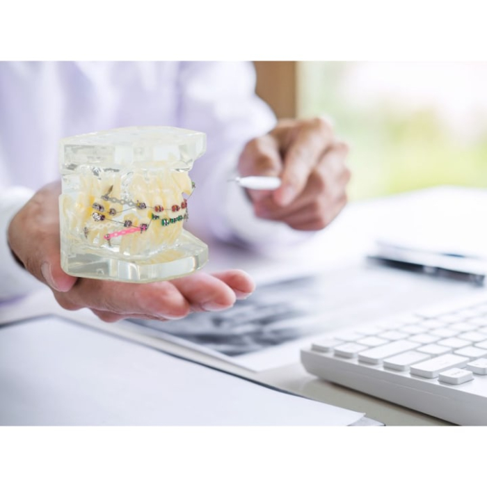 Model dentar maxilar realist cu dentitie si aparat ortodontic VarioShop®, instrument educational pentru cabinete stomatologice, igiena dentara, cursuri si demonstratii medicale [3]