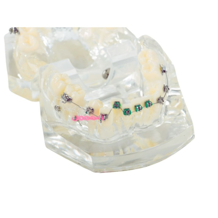 Model dentar maxilar realist cu dentitie si aparat ortodontic VarioShop®, instrument educational pentru cabinete stomatologice, igiena dentara, cursuri si demonstratii medicale [6]