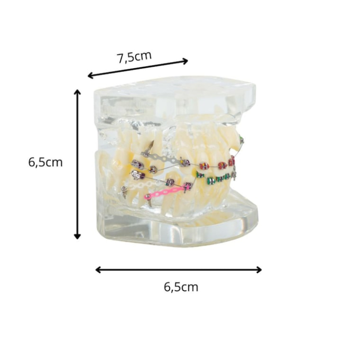 Model dentar maxilar realist cu dentitie si aparat ortodontic VarioShop®, instrument educational pentru cabinete stomatologice, igiena dentara, cursuri si demonstratii medicale [4]