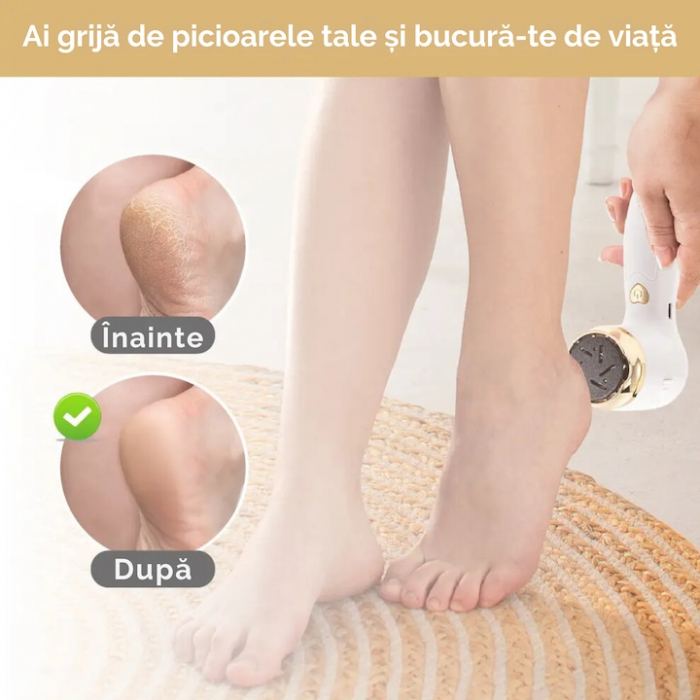 Pila electrica portabila VarioShop®, pentru calcaie si talpi, cu 2 capete detasabile, perie de curatare, 2 viteze, 2000 rotatii/min, incarcare USB, culoare Alb [3]