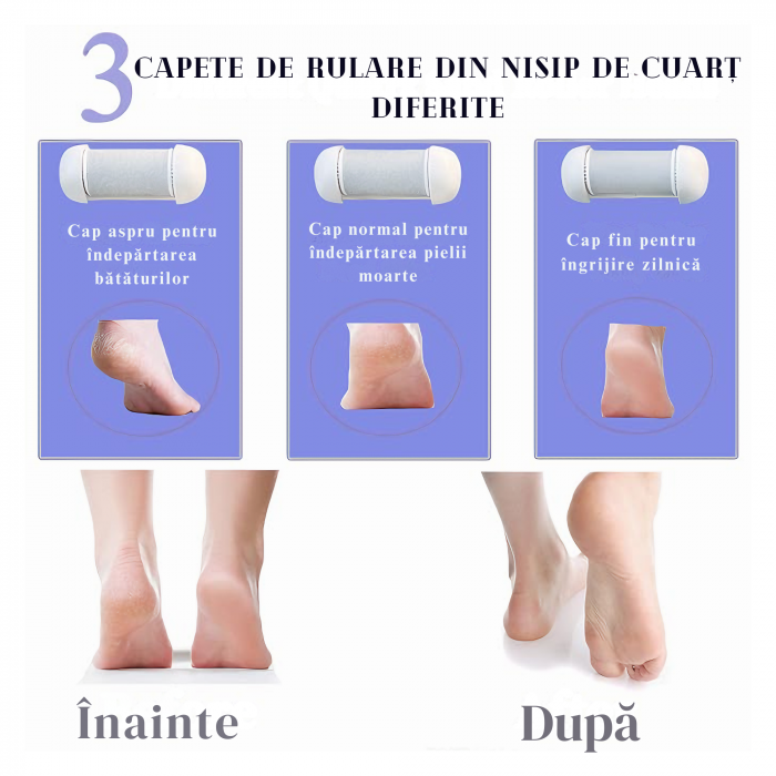 Pila Electrica VarioShop® Pentru Ingrijirea Calcaielor si Talpilor, Afisaj LCD 3 Capete Diferite, Reincarcabila, Fara fir, Rezistenta la Apa, Culoare Alb [11]