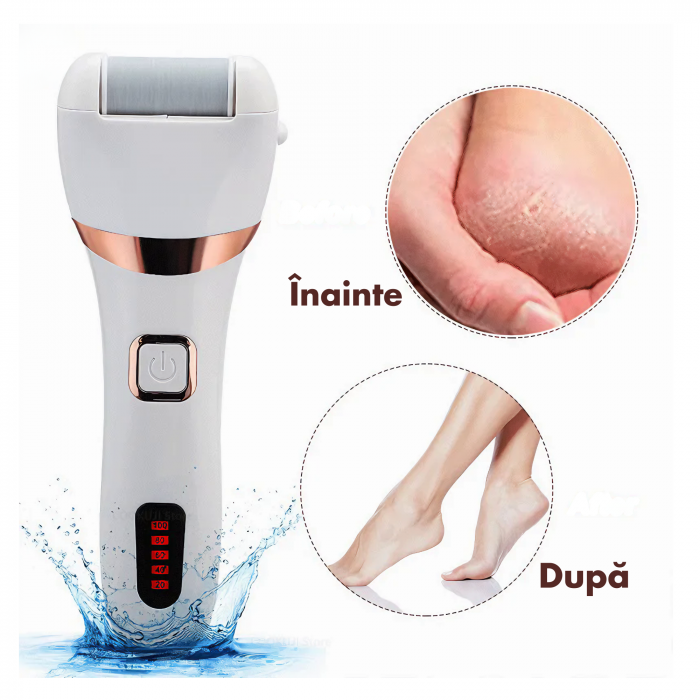 Pila Electrica VarioShop® Pentru Ingrijirea Calcaielor si Talpilor, Afisaj LCD 3 Capete Diferite, Reincarcabila, Fara fir, Rezistenta la Apa, Culoare Alb [3]