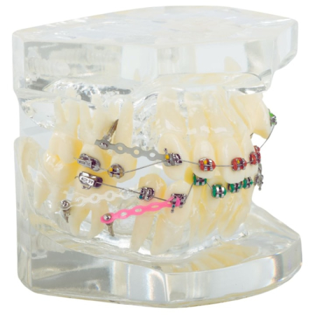 Frumusete & Ingrijire - Model dentar maxilar realist cu dentitie si aparat ortodontic VarioShop®, instrument educational pentru cabinete stomatologice, igiena dentara, cursuri si demonstratii medicale