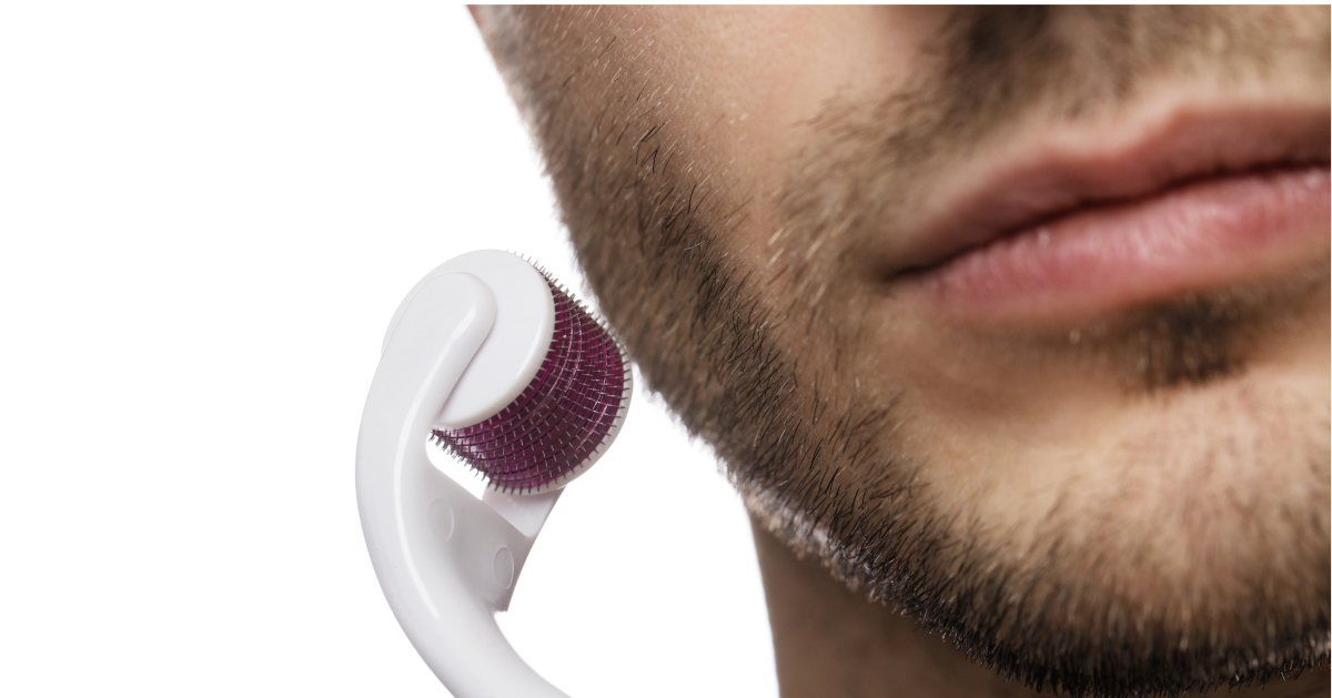 Microneedling: Ghid practic și Beneficii