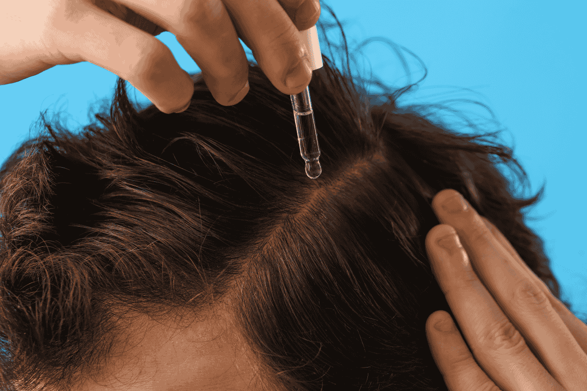 Minoxidil vs. alte soluții de regenerare a părului