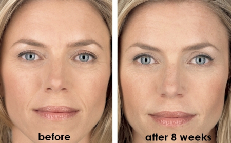 crema lifting antirid [1]