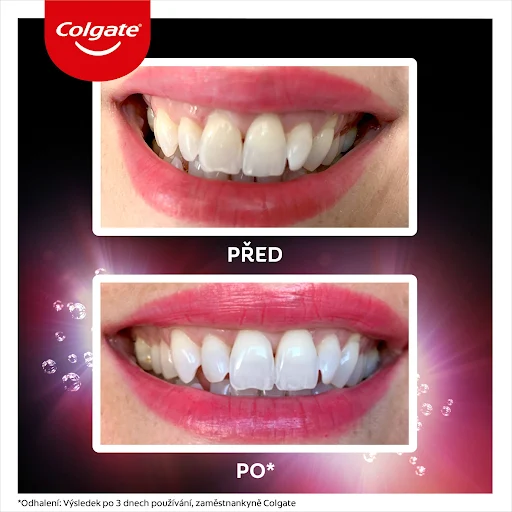 Pasta de Dinti, Colgate Max One, 50 ml [3]
