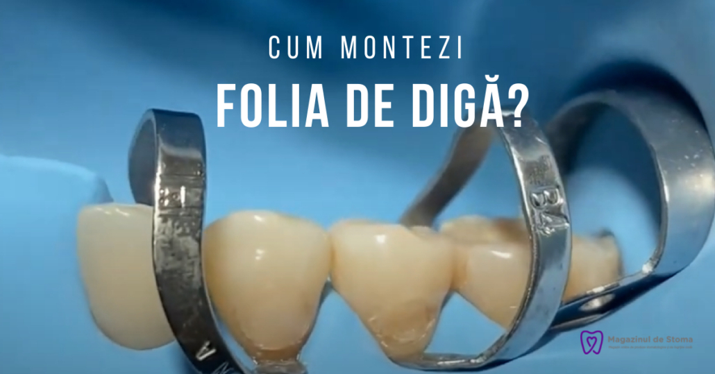 CUM MONTEZI FOLIA DE DIGĂ?