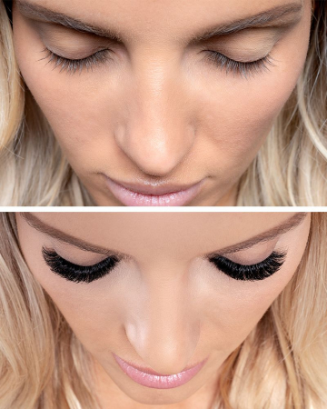 X45/0,07MM GENE OMNI VOLUME™ [2]