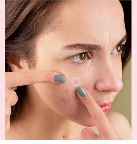 Plasturi pentru Acnee cu Acid Salicilic, 36 buc Acne Patch [4]