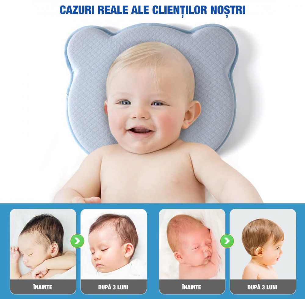 Perna bebelusi FiGGA® pentru formarea capului, Anti Plagiocefalie, Spuma cu memorie, Husa de protectie, Albastru [6]