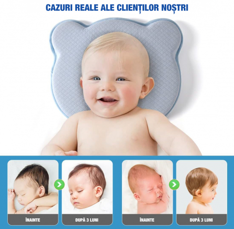 Perna bebelusi FiGGA® pentru formarea capului, Anti Plagiocefalie, Spuma cu memorie, Husa de protectie, Albastru [5]