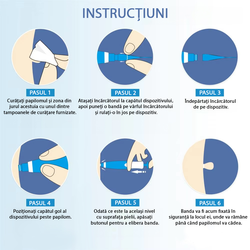Dispositivo per Rimozione Papillomi ZAFIT®, Kit per Rimozione Skin Tag, per Viso, Collo, Corpo, Dimensioni 2-8 mm, 10 Salviette alcoliche, 40 Fasce elastiche, 2 Testine, Grigio [6]