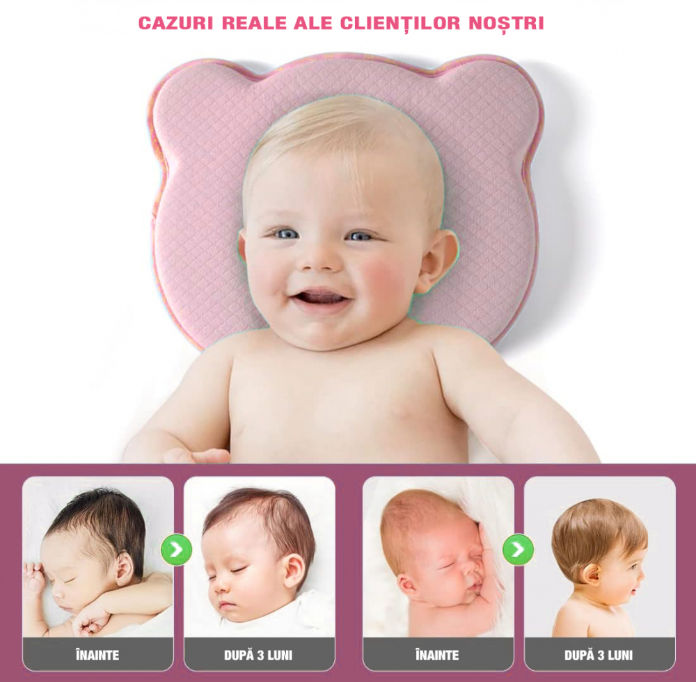 Perna bebelusi FiGGA® pentru formarea capului, Anti Plagiocefalie, Spuma cu memorie, Husa de protectie, Roz [6]