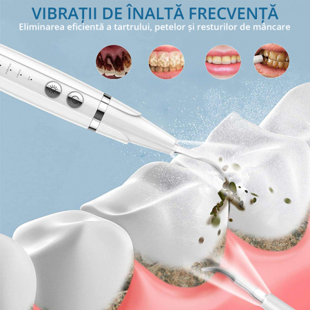 Dispozitiv pentru eliminare tartru, ZENKABEAT Smart Sonic Pro, 5 moduri de lucru, Ultrasonic, Alb [3]