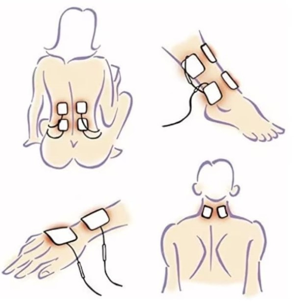 Set 2 electrozi din gel autoadezivi, reutilizabili, compatibili cu aparatele de electrostimulare TENS, EMS, 4 cm [3]