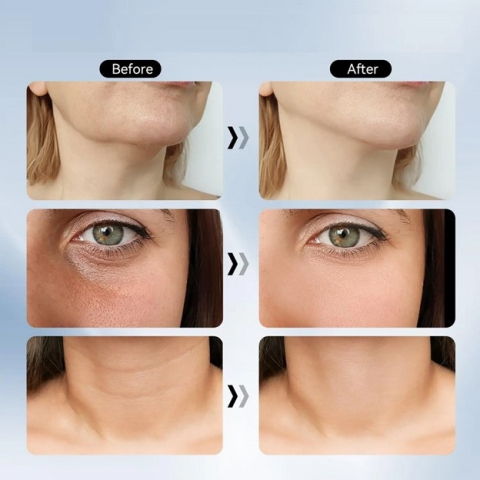 Dispozitiv de Masaj si Lifting Facial cu Terapie LED 7 Culori si incalzire, Alb [6]