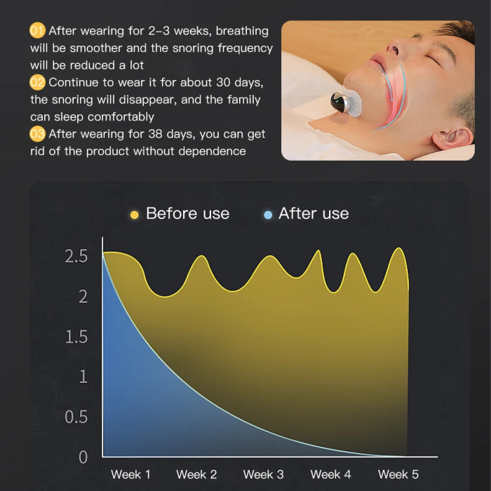 Plasturi de rezerva pentru dispozitiv antisforait AdyMel®, set 30 buc [3]