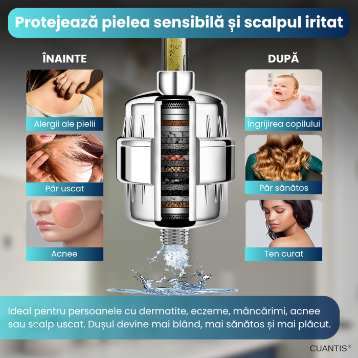 Filtru de duș 25 etape purificare, Vitamina C, KDF-55, carbon activ, compatibil universal [3]
