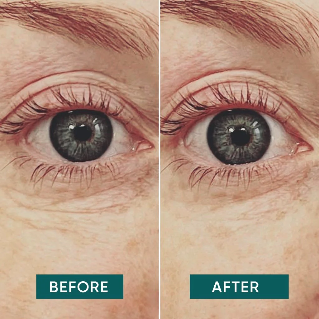 plasturi-antirid-silicon-ochi-apricot-vitamina-c-reutilizabili-30-aplicari [3]