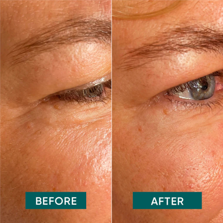 Plasturi Reutilizabili cu Aloe Vera pentru Ochi Apricot – After-Sun & Piele Sensibilă, 2 buc – 30 de Utilizări [2]