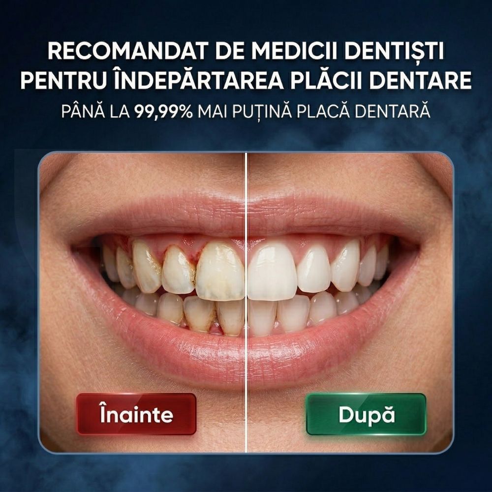 Comparație înainte și după curățarea dinților cu irigatorul iBLU smart, recomandat de medicii dentiști